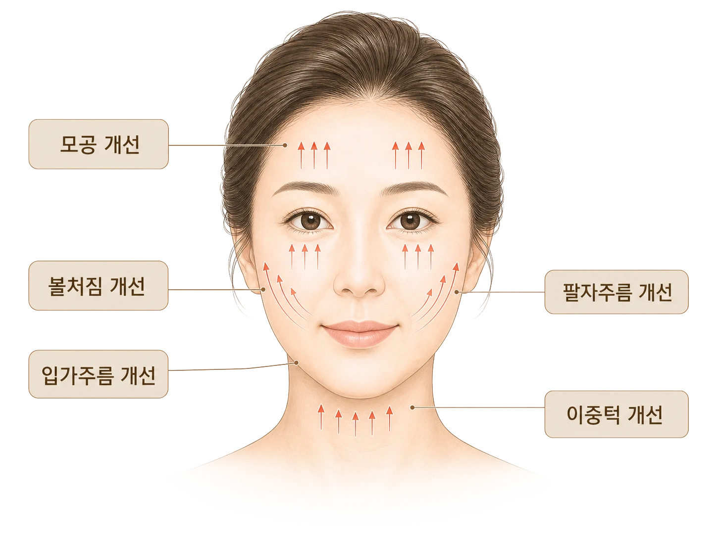 울쎄라 효과