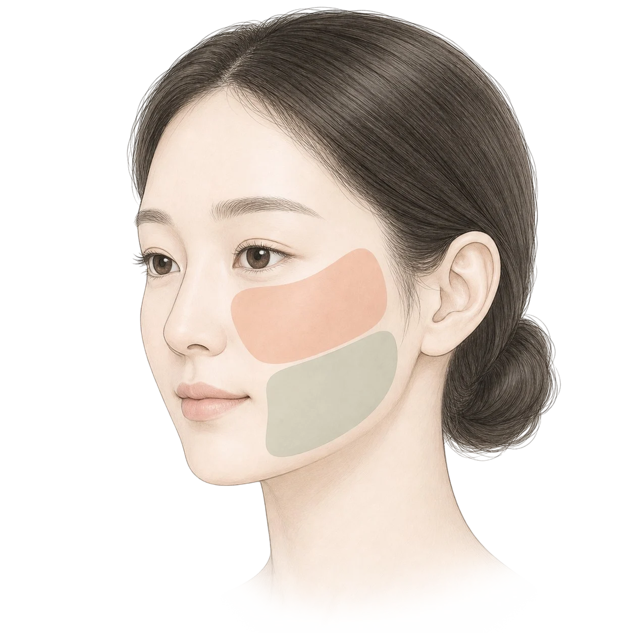 부위별 맞춤 — 얼굴 존에 따라 모드와 깊이를 다르게 시술